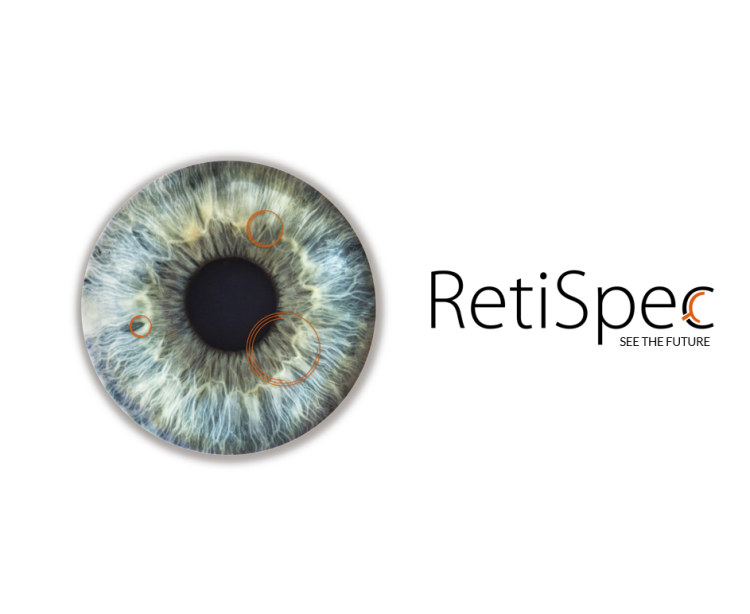 用AI检测阿尔兹海默病,能提前20年判断患病可能